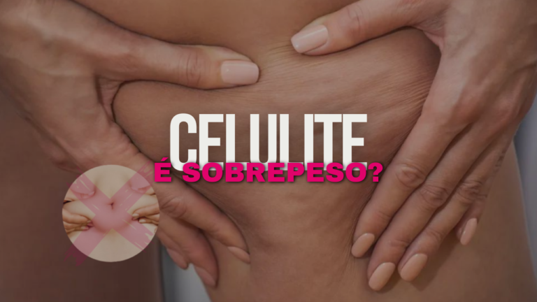 Celulite não é Sinônimo de Sobrepeso: Desvendando os Mitos e Realidades