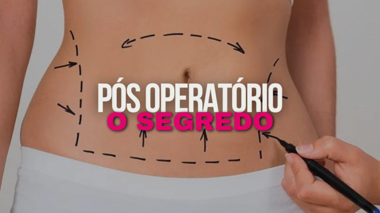 O investimento no pós operatório: A VERDADE QUE NINGUÉM TE CONTA