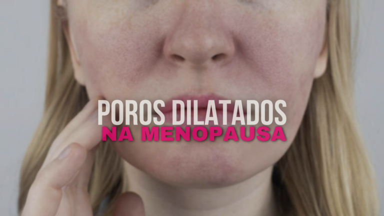 Tratamentos para Minimizar a Aparência de Poros Dilatados