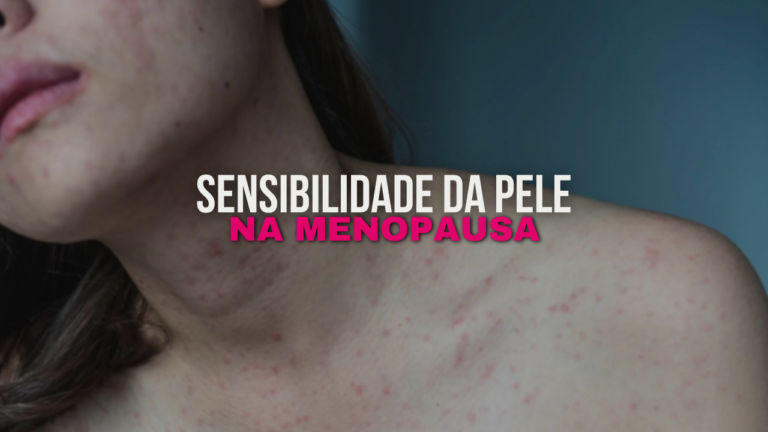 Como Tratar a Sensibilidade Cutânea Durante a Menopausa