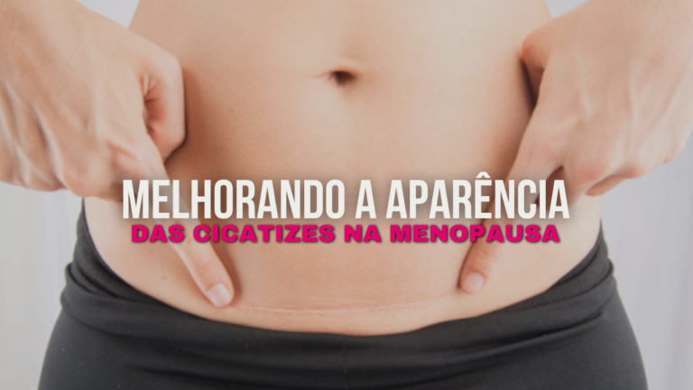 Tratamentos Para Melhorar a Aparência de Cicatrizes na Menopausa