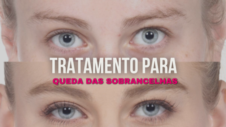 Opções de Tratamento Para Combater a Queda das Sobrancelhas